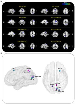 Decreased default mode network functional connectivity with visual processing regions as potential biomarkers for delayed neurocognitive recovery: A resting-state fMRI study and machine-learning analysis
